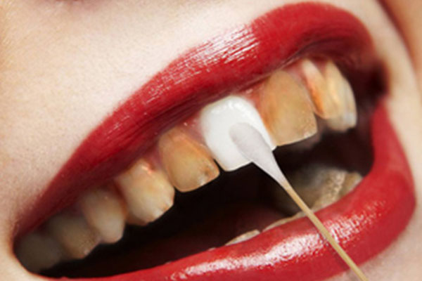 牙齿从小就黄怎么样才能变白(牙齿从小就黄怎么样才能变白呢)