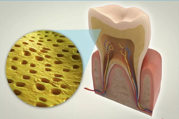 牙齿楔状缺损轻微用补吗多少钱(牙齿楔状缺损轻微用补吗多少钱)