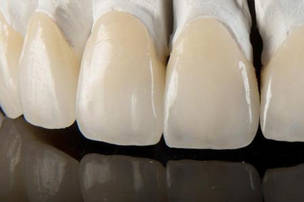 瓷贴面做完会比原来牙齿有什么变化(瓷贴面做完以后牙齿会变大)