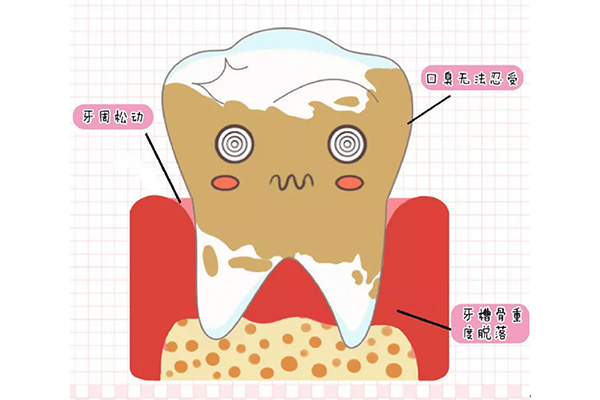 牙黄怎么去除小窍门(牙黄如何去除)