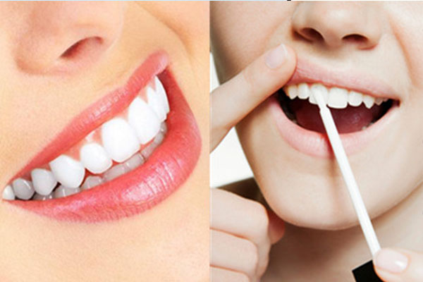 两颗牙齿中间缝隙黑了是什么原因造成的(两颗牙齿中间缝隙黑了是什么原因造