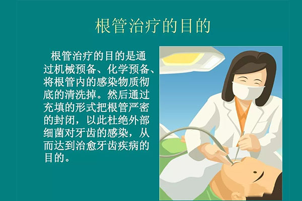 什么是牙髓炎根管治疗