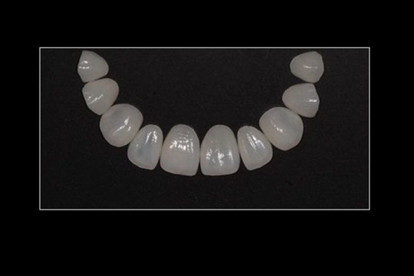 牙齿树脂贴面卸掉以后牙齿会裂吗(牙齿树脂贴面卸掉以后牙齿会裂吗)