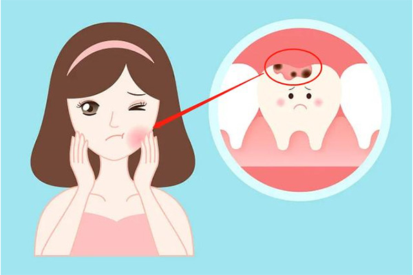 牙齿缺损一小块怎么回事啊吃什么药能好呢(牙齿缺损一小块怎么回事啊吃什么