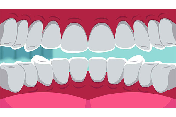 洁牙器是什么材料做的(洁牙器是什么材料做的呢)