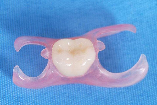 树脂琉璃瓦的寿命能管多少年(树脂琉璃瓦的寿命能管多少年呢)