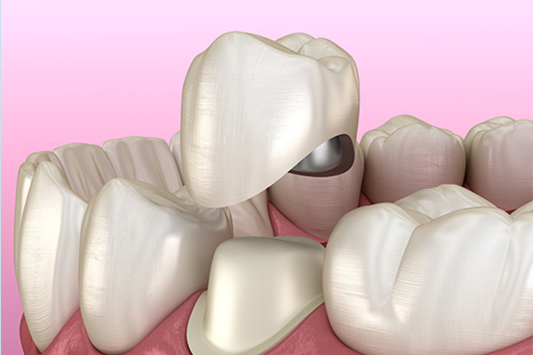 一个牙医的良心忠告 补牙(牙医补补怎么样)