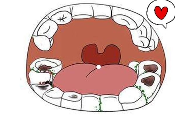 补全瓷牙的过程会不会痛呀(补全瓷牙的过程会不会痛呀怎么办)