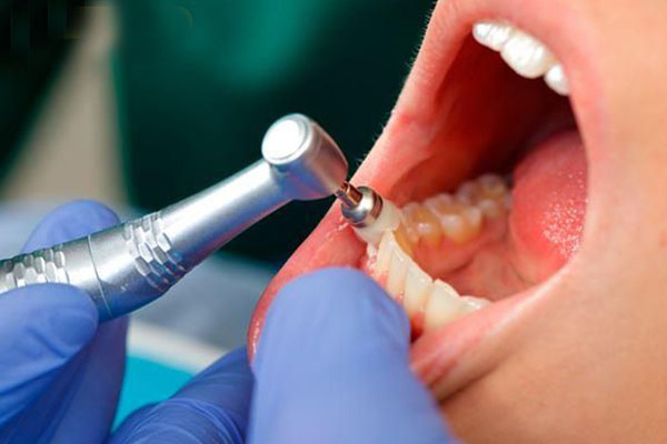 脱敏牙膏敷在牙齿上有疼痛正常吗(脱敏牙膏敷在牙齿上有疼痛正常吗怎么办)