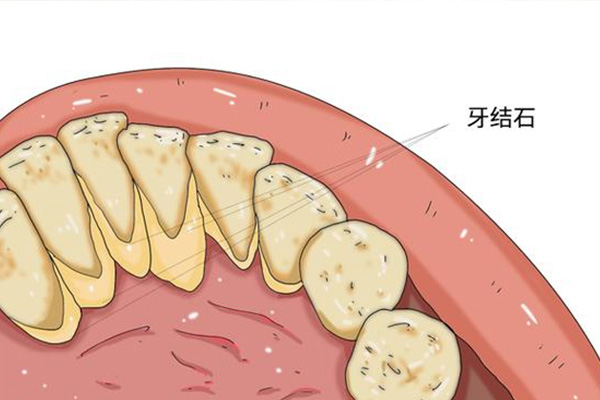 牙齿天生发黄怎么办小妙招(牙齿天生发黄怎么办小妙招视频)