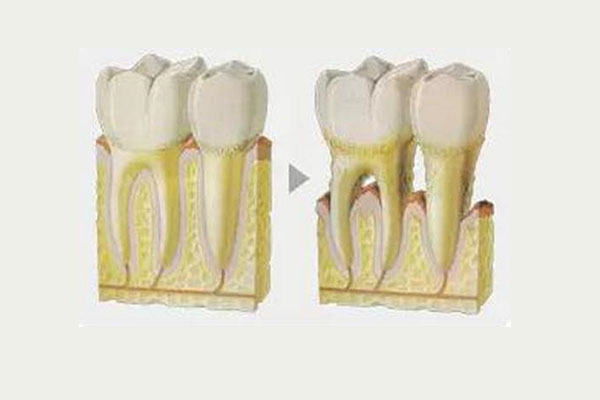牙体缺损的修复方法和各自优点是什么(牙体缺损的修复方法和各自优点是什么