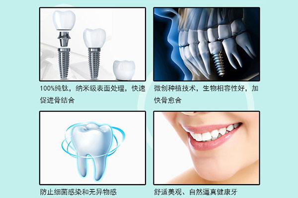 广西种牙哪个医院好(广西种牙哪个医院好些)