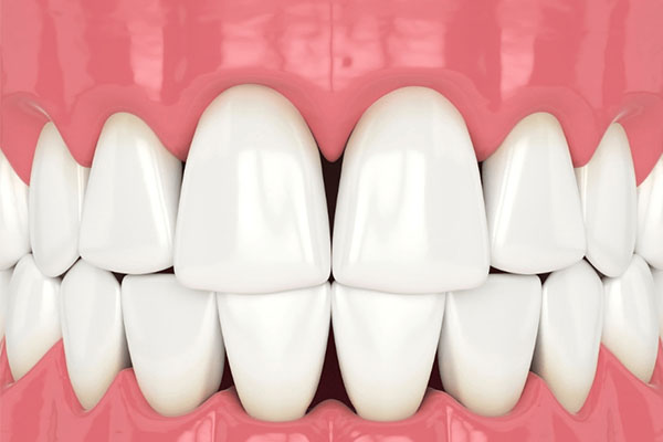 什么成分的牙膏美白(什么成分的牙膏美白牙齿效果好)