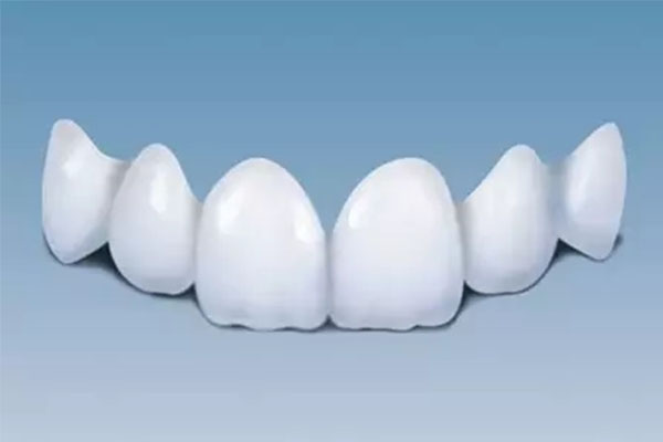 牙贴面对比效果(牙贴面对比效果图片)