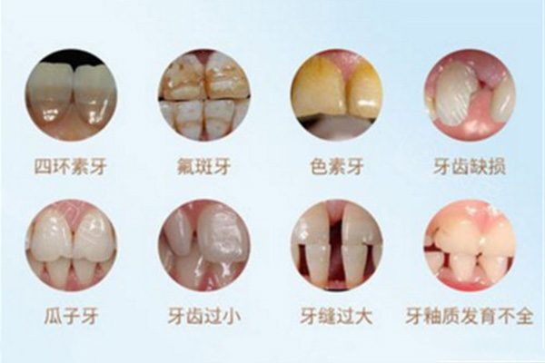 孩子牙齿黄的怎么回事(孩子牙齿黄的怎么回事啊)