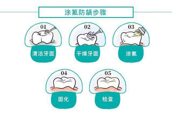 窝沟封闭是乳牙做还是恒牙做(窝沟封闭是做乳牙还是新牙)