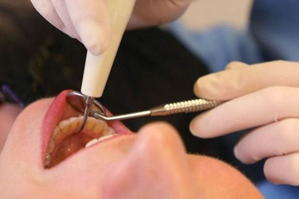 牙体缺损修复的基本原则包括什么(牙体缺损修复的基本原则包括什么和什么)