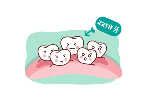 牙侧面长了个小牙尖是什么病(牙侧面长了个小牙尖是什么病图片)