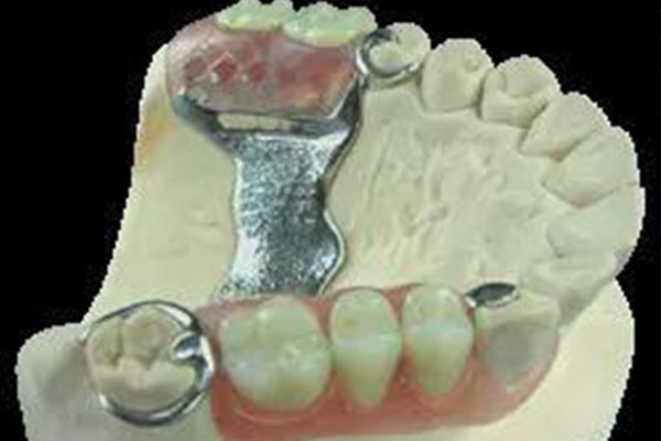 树脂瓦几年就老化了(树脂瓦几年就老化了距离平阴最近的树脂瓦厂是那里)