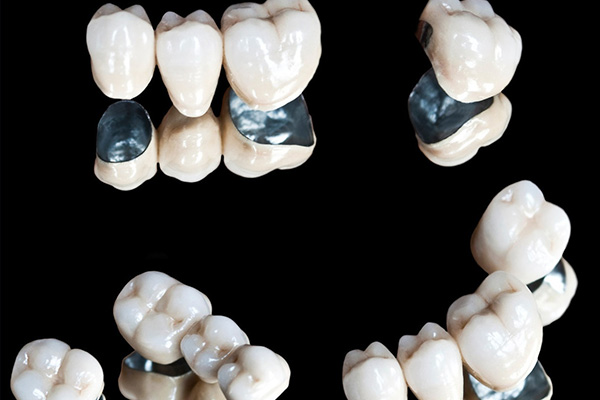 树脂排水沟使用寿命多少年(树脂排水沟的寿命)