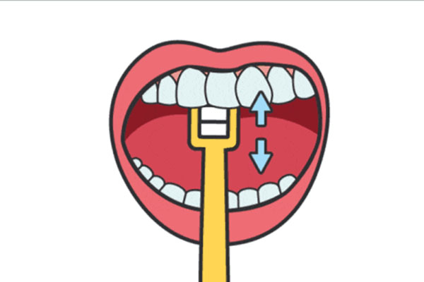 5秒脱落牙结石 洗牙多少钱(5秒脱落牙结石 洗牙多少钱一颗)
