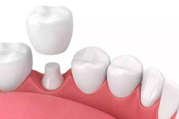 补牙后牙不敢使力咬东西怎么回事呢怎么治疗(补牙后牙不敢使力咬东西怎么回