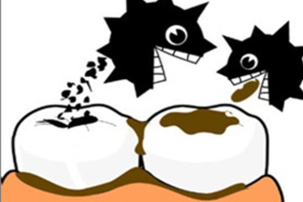 五岁龋齿怎么办,必须要治吗(五岁龋齿怎么办,必须要治吗图片)