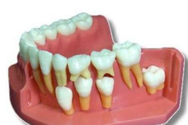 牙齿旁边长了一个小牙(牙齿旁边长了一个小牙齿图片)