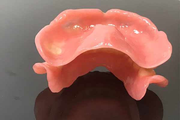 预防性树脂充填的适应症不包括(预防性树脂充填的适应症不包括哪些)