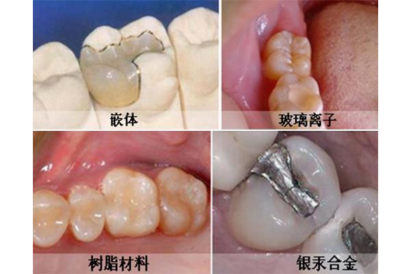 南京口腔医院补牙收费标准最新文件
