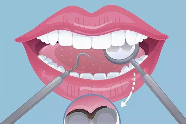 牙齿喷砂可以美白吗多少钱一次啊(牙齿喷砂可以美白吗多少钱一次啊)