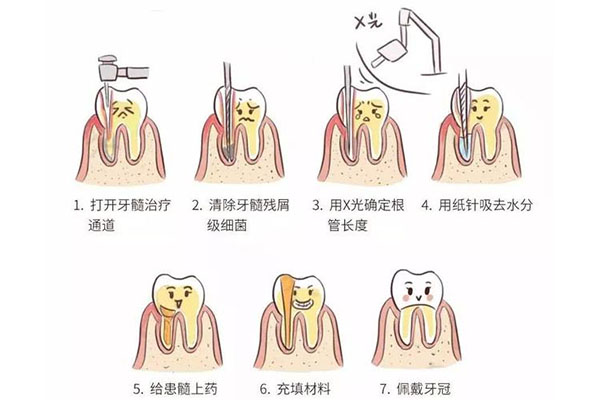 补牙之后为什么还会疼(补牙之后为什么还会疼痛)