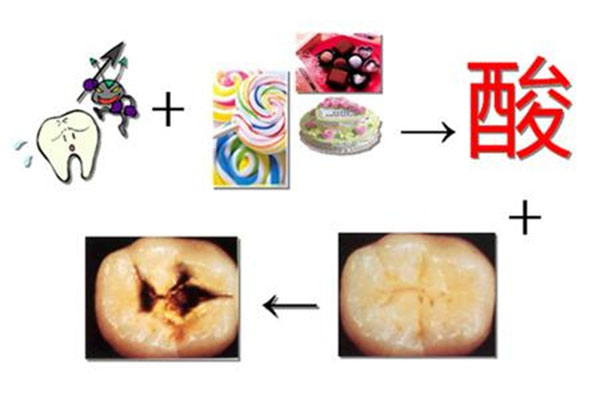 脱敏素牙膏的功效可以刷白牙齿吗怎么用(脱敏素牙膏的功效可以刷白牙齿吗怎