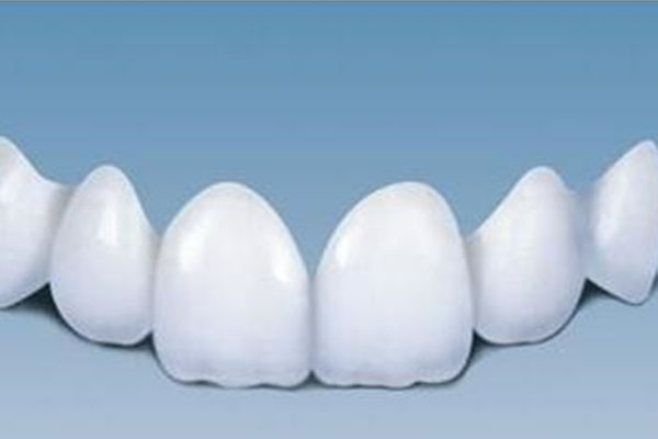 全瓷牙齿贴面的好处与坏处有哪些呢(全瓷牙齿贴面的好处与坏处有哪些呢视频