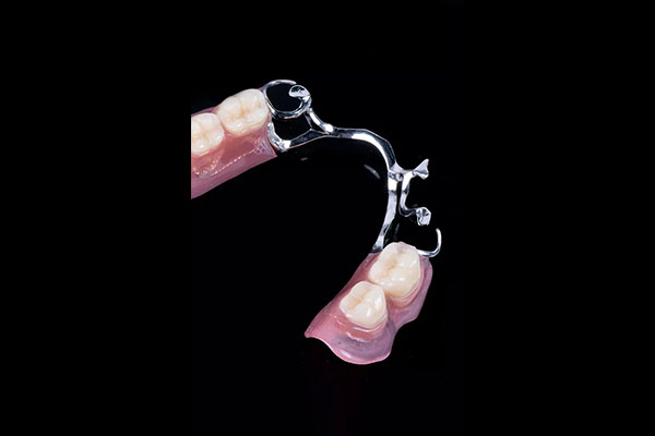 树脂充填术多少钱(树脂充填术多少钱一个)