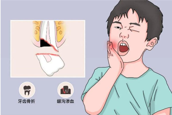 牙齿缺损一小块不痛严重吗怎么办呢吃什么药最好(牙齿缺损一小块怎么回事)