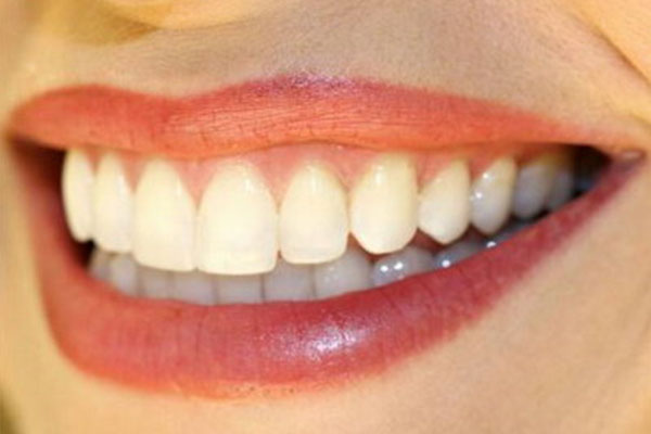 牙齿美白冷光缺点(牙齿美白冷光缺点什么)