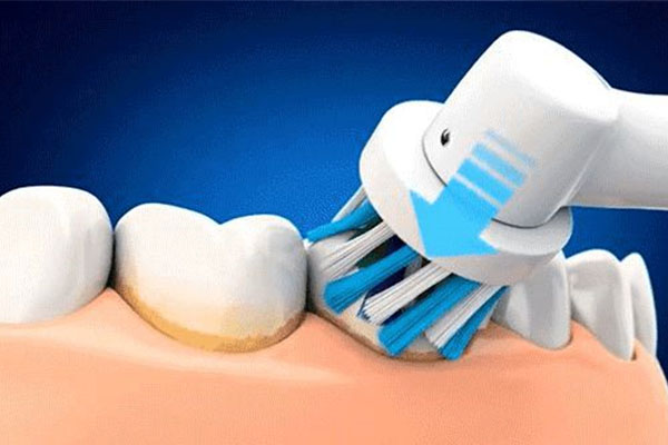 洗完牙为啥还是黄的