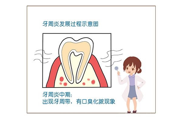 小孩牙周发炎怎么治疗最有效(小孩牙周发炎怎么治疗最有效的方法)