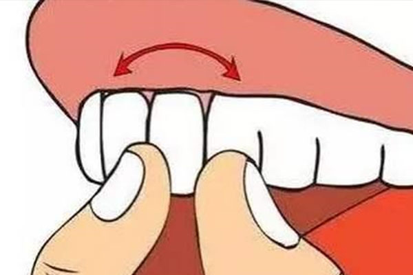 牙齿贴面的(牙齿贴面的价格是多少钱一颗)