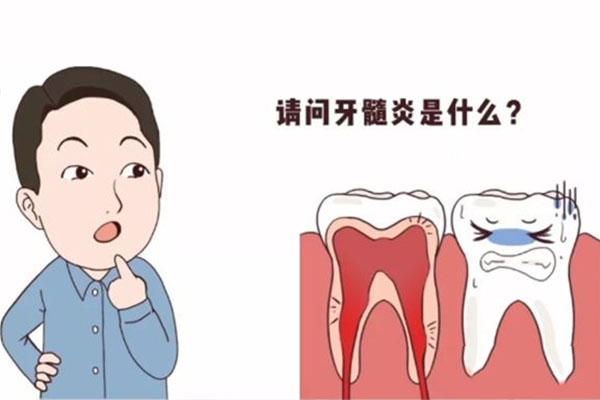 牙髓炎快速止疼偏方4种药半小时就不疼了吗为什么(牙髓炎止疼吃什么药)