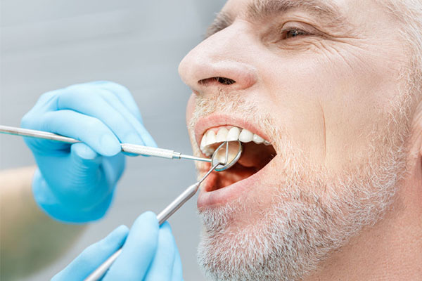 乳牙滞留的常见原因有什么影响(乳牙滞留的常见原因有什么影响因素)