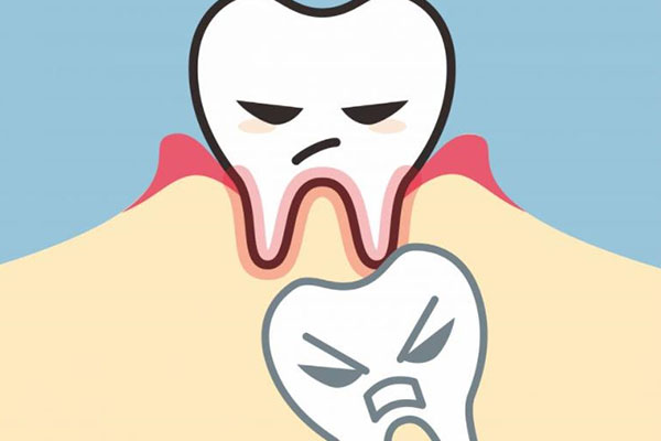 乳牙滞留是指定考虑牙齿吗(乳牙滞留是指定考虑牙齿吗)