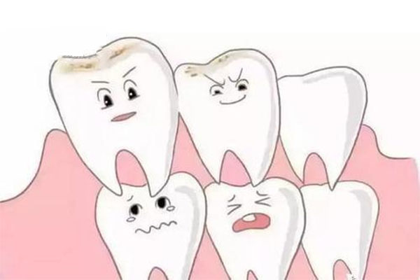 乳牙滞留诊断标准最新规定(乳牙滞留诊断标准最新规定图片)