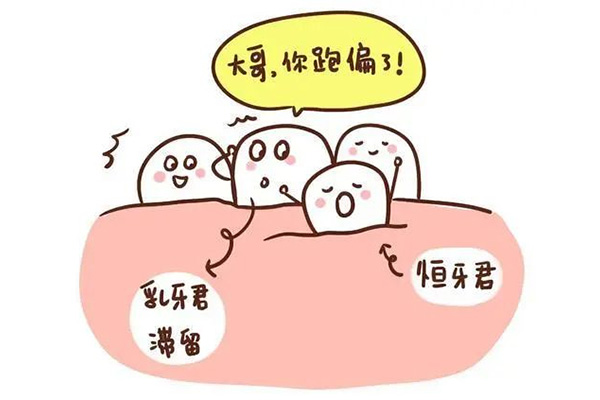 乳牙滞留恒牙错位严重怎么办(乳牙滞留恒牙错位严重怎么办图片)