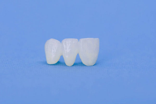 牙齿贴面微笑线设计(牙齿瓷贴面能做出微笑线吗)