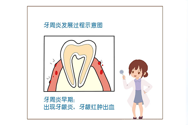 牙周炎牙齿松动了(牙周炎牙齿松动了能自愈吗)