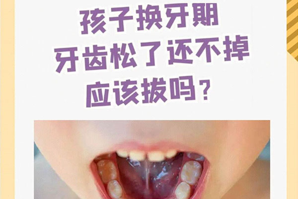 乳牙滞留指的是哪些牙齿呢解说(乳牙滞留指的是哪些牙齿呢解说图)