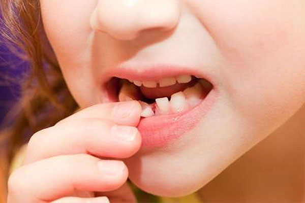 为什么出现乳牙滞留(为什么出现乳牙滞留现象)