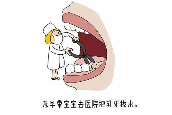 乳牙滞留拔掉后要注意什么(乳牙滞留拔掉后要注意什么饮食)